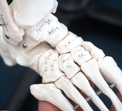 Bone Sonometers Market by Product and Geography - Global Forecast 2019-2023